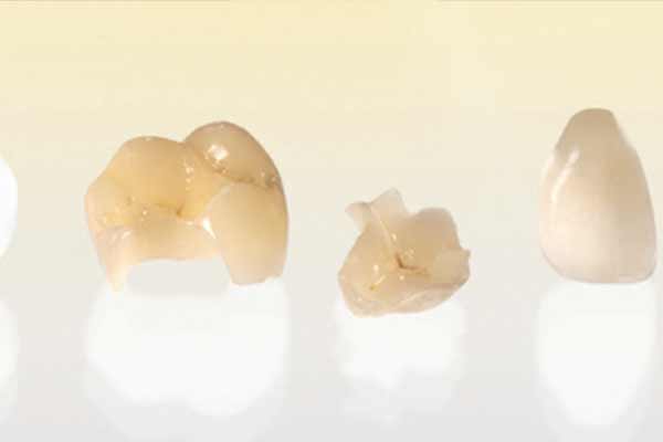 Strong lasting Tooth coloured fillings in Hawthorn